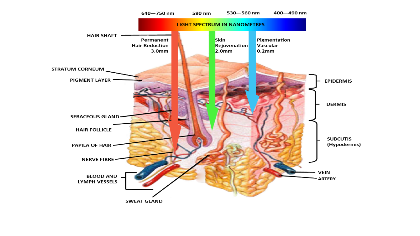 Skin layer IPL